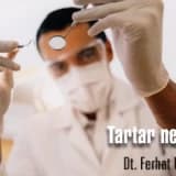 Tartar (diştaşı) nedir?