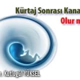 Kürtaj sonrası kanama olur mu?