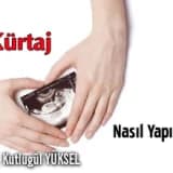 Kürtaj nasıl yapılır? İyileşme süreci nasıldır?