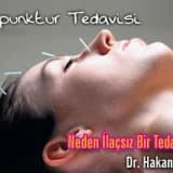 Akupunktur tedavisi neden ilaçsız bir tedavidir ?