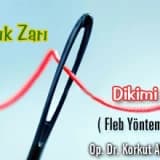 Kızlık zarı dikimi - fleb yöntemi