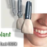 İmplant
