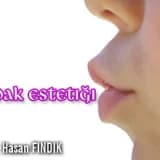 Dudak Estetiği