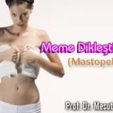 Meme dikleştirme (mastopeksi)