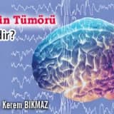 Beyin tümörü nedir?
