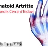 Romatoid artritte ortopedik cerrahi tedavi