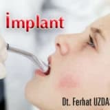 İmplant; diş eksikliğine harika çözüm