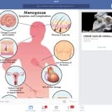 Tekrarlayan vulvovaginal enfeksiyonlar