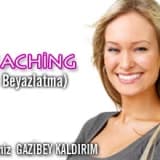 Bleaching (diş beyazlatma) beyaz dişler mutlu gülüşler