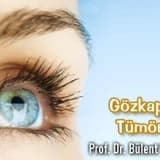 Gözkapağı tümörleri