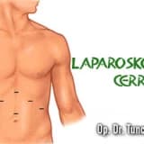 Ürolojide Laparoskopik Cerrahi