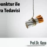 Akupunktur ile sigara tedavisi