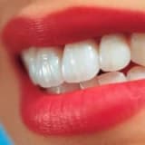 Diş ağartmada  (bleaching)  güncel bilgiler