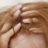 Saç koparma hastalığı (trikotillomani)