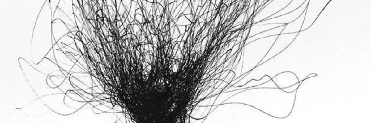 KORKUYLA NE YAPMALI?