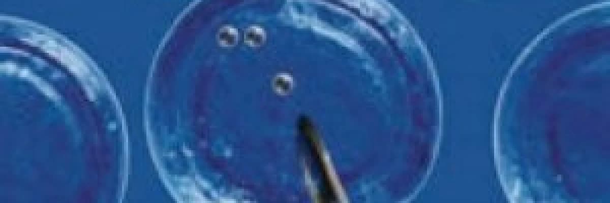 Tüp bebek ve yardımcı üreme tekniikleri