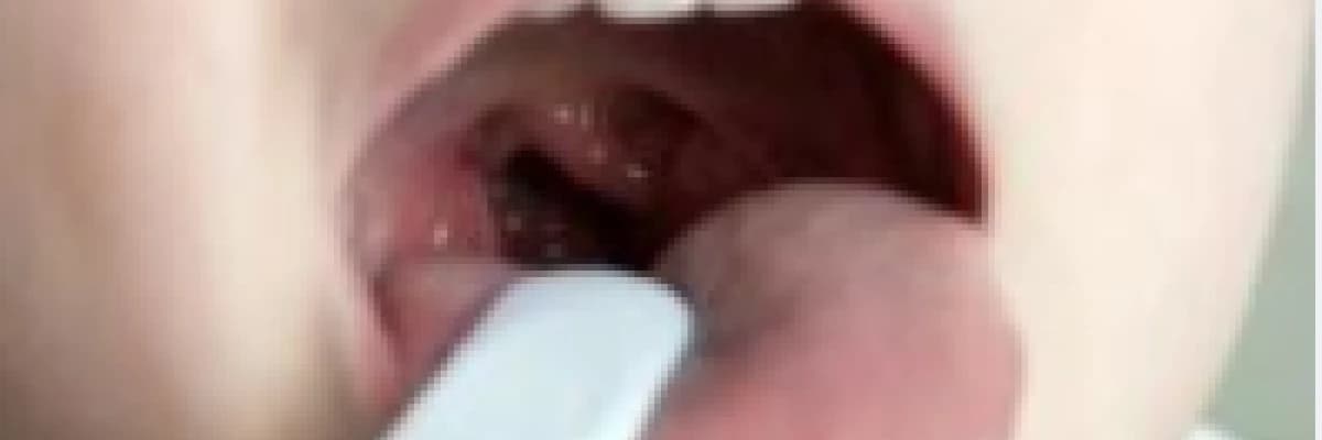 Adenoid Vejetasyon Hakkında