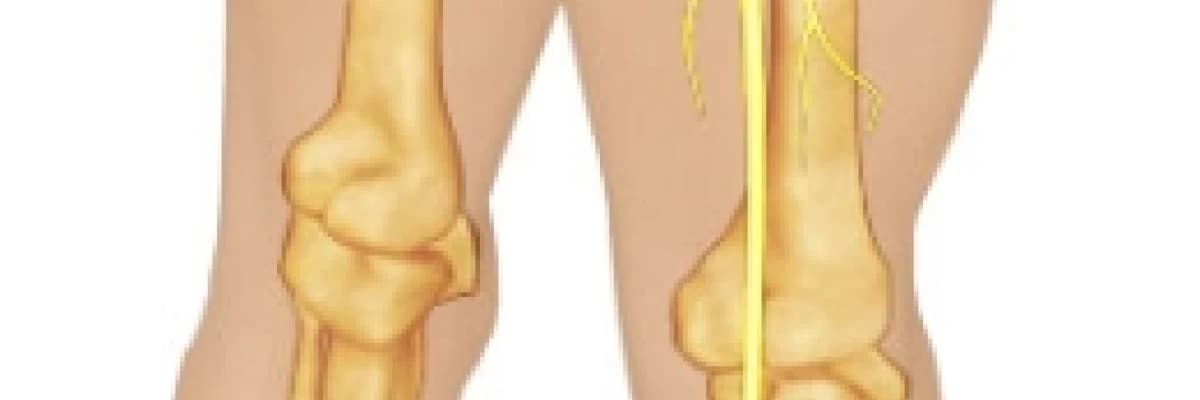 KALÇA AĞRISI İLE GİDEN PRİFORMİS SENDROMU