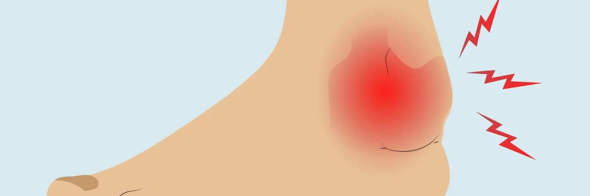 BEHÇET HASTALIĞI VE TEDAVİ YAKLAŞIMI