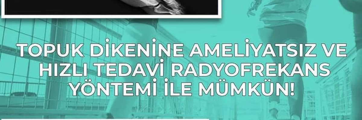 Topuk dikenine ameliyatsız ve hızlı tedavi radyofrekans yöntemi ile mümkün!