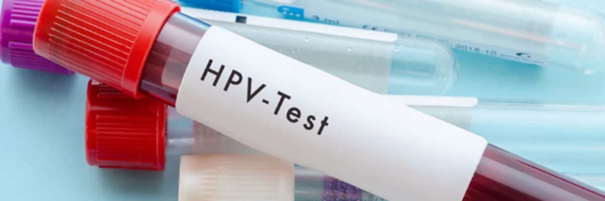 HPV testi nedir?