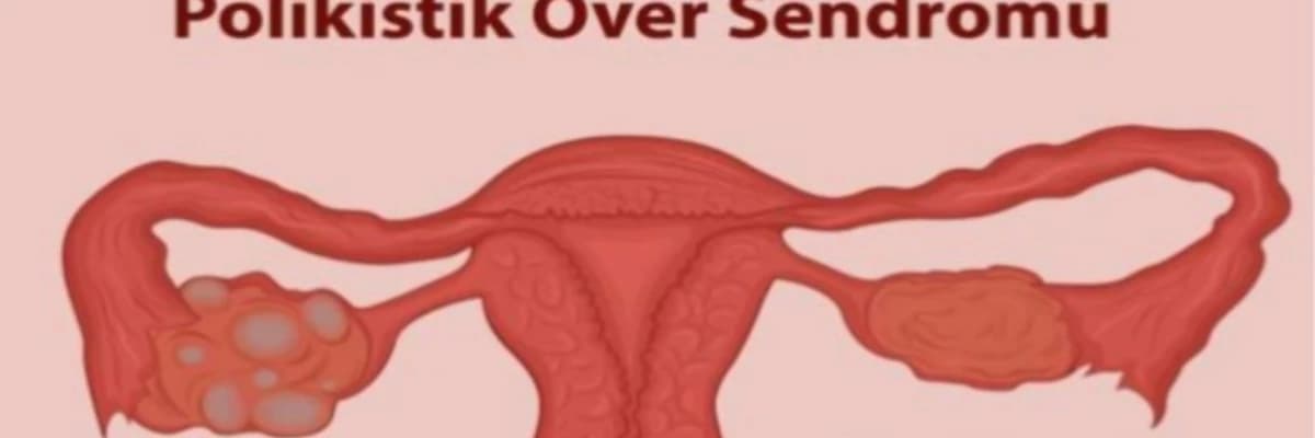 POLİKİSTİK OVER SENDROMU
