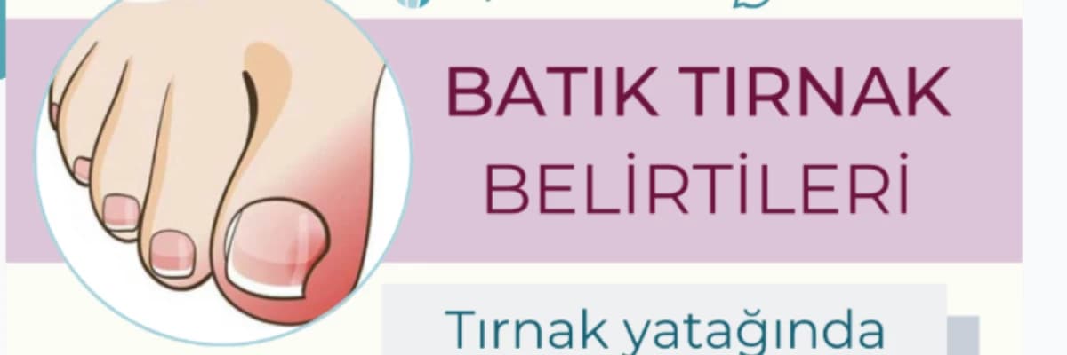 Tırnak Batması Hakkında Neler Biliyoruz?