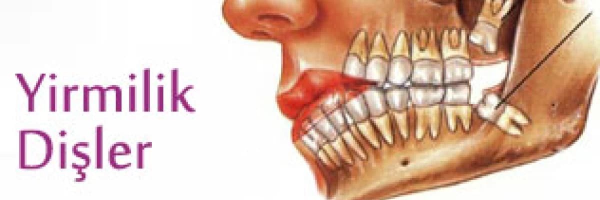 Yirmilik dişler
