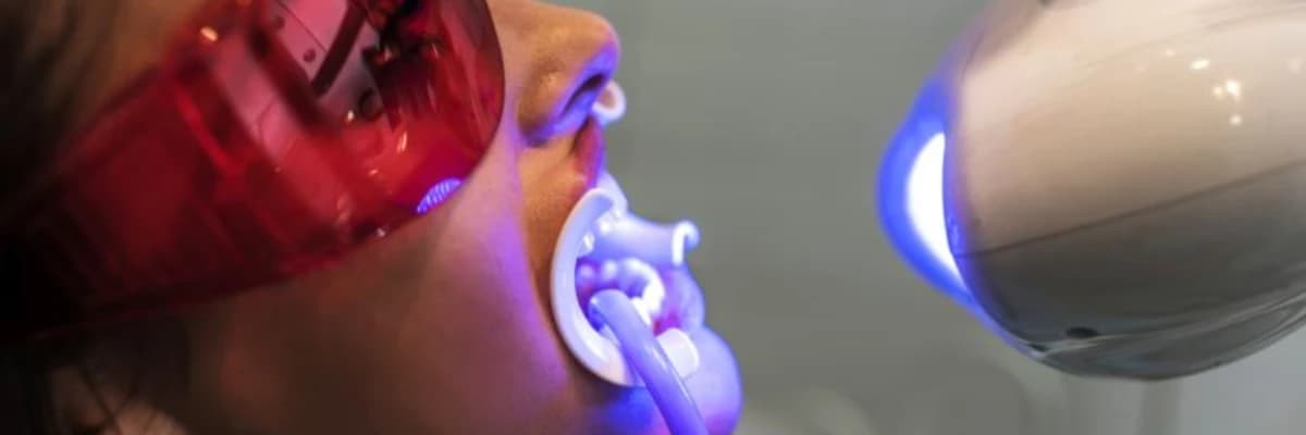 Diş Beyazlatma İşleminin Yan Etkileri