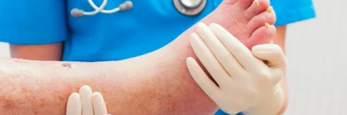 DİYABETİK AYAK BAKIMI