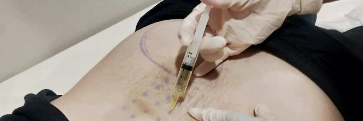 Bel ağrılarında, Bel Fıtıklarında Mezoterapi Uygulamaları