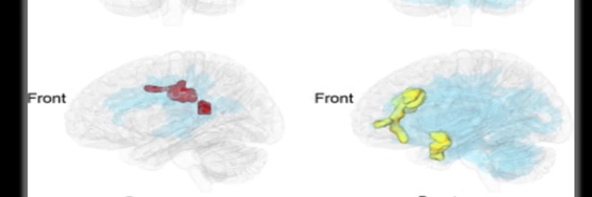 İki Dil İle Büyümek Avantaj mı ? Yoksa Dezavantaj mı ?