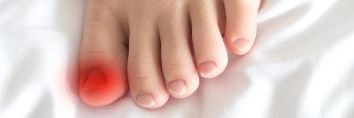 HAMİLELİK VE ERGENLİK DÖNEMLERİNDE TIRNAK BATMASI: PODOLOJİK YAKLAŞIMLAR VE BİLİMSEL DEĞERLENDİRME