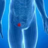 Kasık Fıtığı Ameliyatı Sonrasında