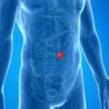 Göbek Fıtığı Ameliyatı Sonrasında