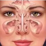 Sinüzit Nedir, Sebepleri Nelerdir ?