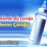 Bebeklerde diş çürüğü (biberon çürüğü)
