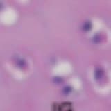 Peritoneum and omentum are natural reservoirs for chondrocytes of osteochondral autografts: a comparative animal study