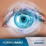 Kornea Nakli