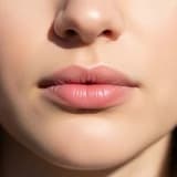 Dudak Dolgusunda En Büyük Hata: Yüz Oranlarını Unutmak