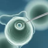 Amniyosentez testinin riskleri nelerdir?