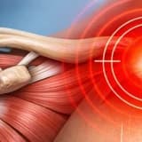 Omuz Ağrısı ve Nedenleri