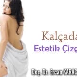 Kalça, Popo ve Estetik Çizgiler