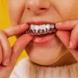 Çocuklar İçin Telsiz Ortodonti