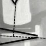 Oxford Unicondylar Knee Arthroplasty Hybrid and Cementless Fixation: Is There Any Difference in Short-term Follow-up?