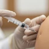 Aşılama yöntemi nedir?