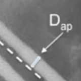 Risk factors for cut-out of double lag screw fixation in proximal femoral fractures
