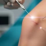 Diz Çevresi Medial Taraf Yumuşak Doku Yaralanmalarında Minimal İnvaziv Tedavi Seçenekleri