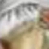 Lateral Collateral Ligament and Biceps Femoris Tendon Fixation with a Suture Anchor to the Tibial Metaphysis after Proximal Fibula En Bloc Resections Preserve Lateral Knee Stability