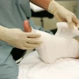 Diyabetik Ayak Yaraları